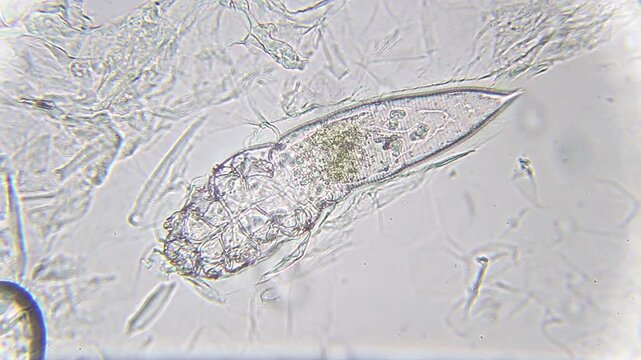 Demodex brevis mite with clearly visible chitin structure and internal anatomy under 400x brightfield microscopy. Detailed 4k microscopic view of a skin parasite.