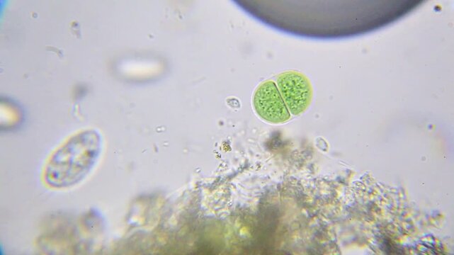 Cyanobacterium in cell division surrounded by bacteria and protozoa under 2000x brightfield microscopy with immersion oil. 4K scientific microscopy footage.
