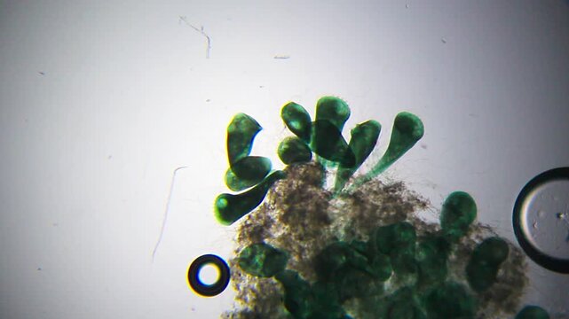 Colony of Stentor ciliates attached to substrate under 40x brightfield microscopy. 4K scientific footage showing protozoan colony structure.