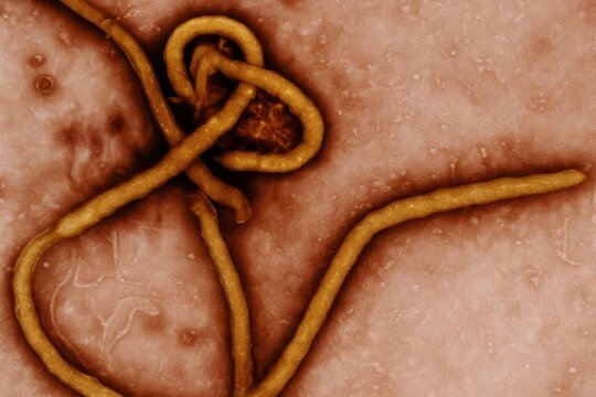 image.jpegParasitic worm close up on human skin macro medical infection concept
