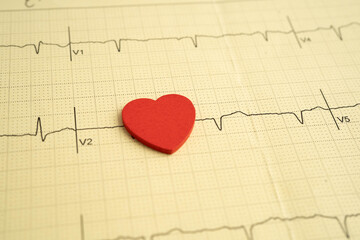 Electrocardiogram ECG heart wave, heart attack, cardiogram report.