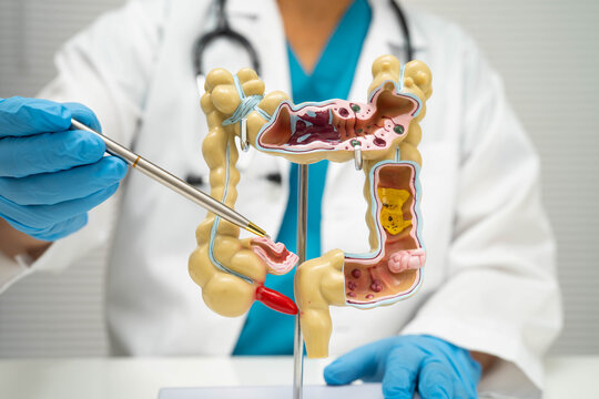 Intestine, doctor holding human model in hospital.