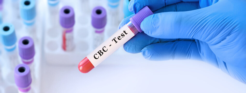 Doctor holding blood sample tube for cbc test, complete blood count laboratory diagnostics for general health screening, infection detection, anemia evaluation and clinical analysis, copy space