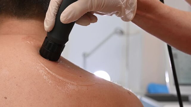 Physiotherapy session with shockwave therapy device on male patient&rsquo;s upper back. Professional therapist treats chronic pain and posture correction using modern rehabilitation equipment closeup