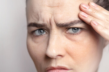 Glabellar lines, folds in a middle-aged woman with blue eyes. Caucasian woman with wrinkles on the bridge of her nose and between the eyebrows close up photo