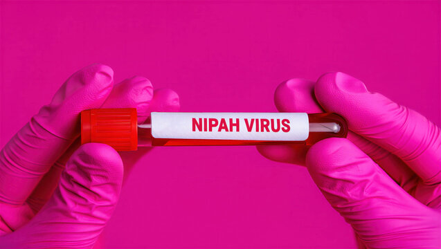 Labeled blood sample for Nipah virus testing held in gloved hands, diagnostic specimen tube for viral detection in BSL-4 laboratory, clinical virology research background