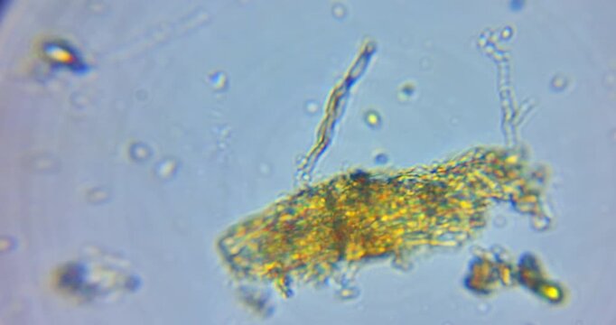 microscope video displaying real movement of living microorganisms commonly found in pond water and soil extracts.