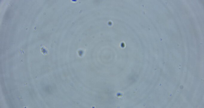 real microscopic footage capturing living microorganisms in natural freshwater. The video shows authentic movement of protozoa, ciliates, rotifers, microalgae