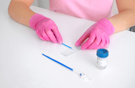 Laboratory technician in pink gloves preparing medical sample on glass slide for diagnostic testing. Healthcare, clinical analysis, research and laboratory procedure concept