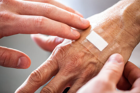 A close up of nurses hands applying a hydrocolloid bandage onto an elderly persons hand in a healthcare setting 