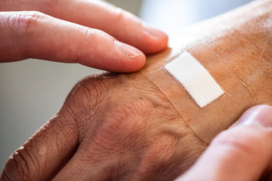 A close up of nurses hands applying a hydrocolloid bandage onto an elderly persons hand in a healthcare setting 