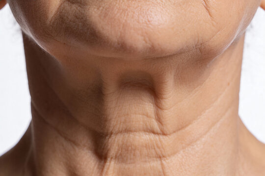 Close-up of an elderly neck with visible wrinkles and sagging skin. Natural aging skin texture is highlighted against a neutral background. Concept of elderly care and skin aging.