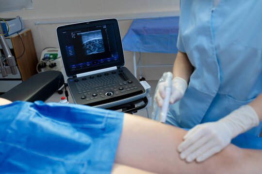 Vascular specialist examining leg veins with ultrasound.