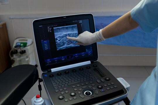 Vascular specialist examining patient leg veins on ultrasound display.