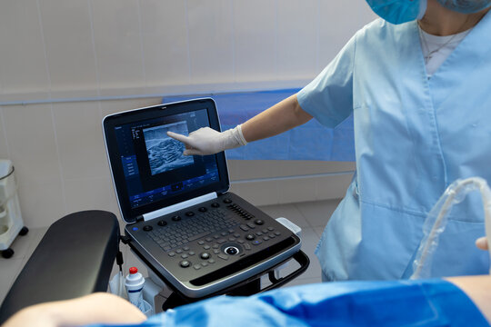 Medical professional reviewing leg vein ultrasound scan.