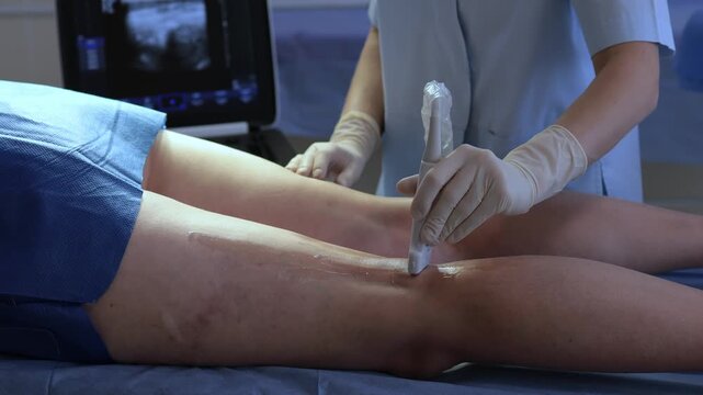4k video Leg ultrasound for vein check by vascular surgeon. Ultrasound examination of leg veins.