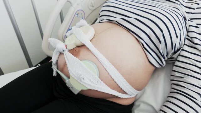 Pregnant woman receiving cardiotocography test in hospital
