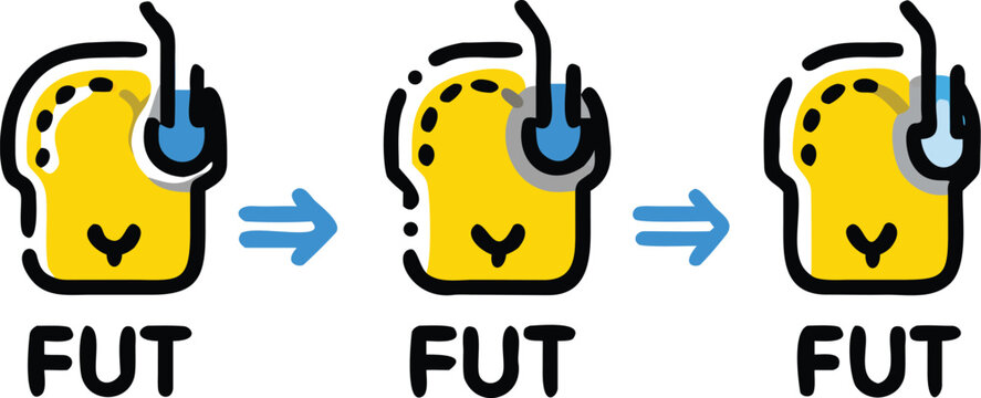 fue vs fut hair transplantation illustration