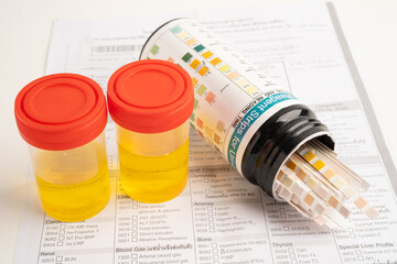 Urinalysis, urine cup with reagent strip pH paper test and comparison chart in laboratory.
