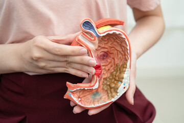 Stomach disease, Asian woman holding anatomy model for study diagnosis and treatment in hospital.