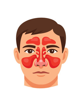 colored flat icon vector illustration isolated on white background nose and sinuses diagram with congested red areas sinus infection concept