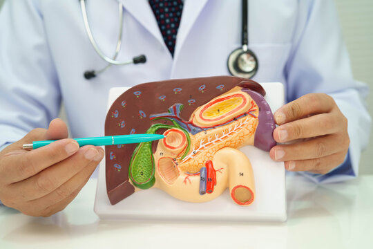 Cirrhosis, Liver cancer, fatty liver, Asian doctor with liver human anatomy model in World Hepatitis Day at hospital.