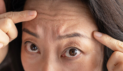 closeup portrait of Asian middle age woman showing her skin closeup showing wrinkles in her...