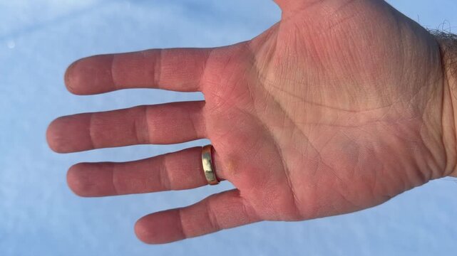 Thumbs Up Gesture with Cold Hand in Snow. Man's hand gives thumbs-up sign against backdrop of blue-tinted snow. Skin is visibly red and dry from freezing winter air.