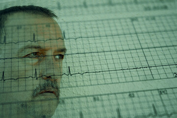 Worried adult male face over damaged electrocardiogram showing cardiac distress