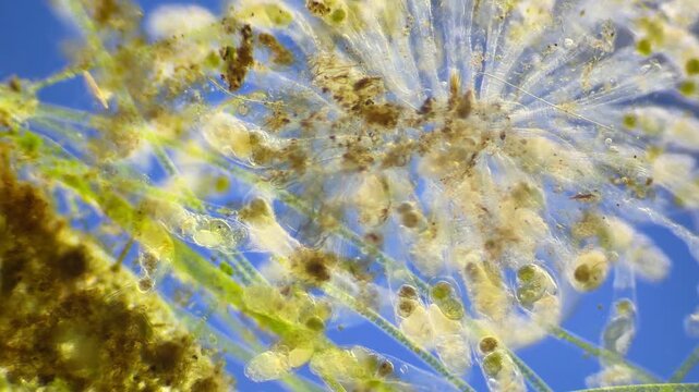 Sinantherina （rotifer） under the microscope