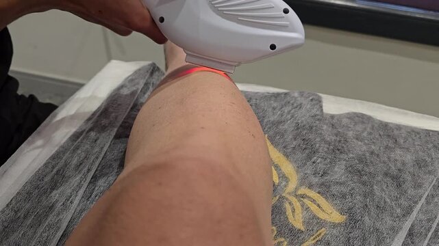 Performing a treatment with a device at a laser hair removal clinic