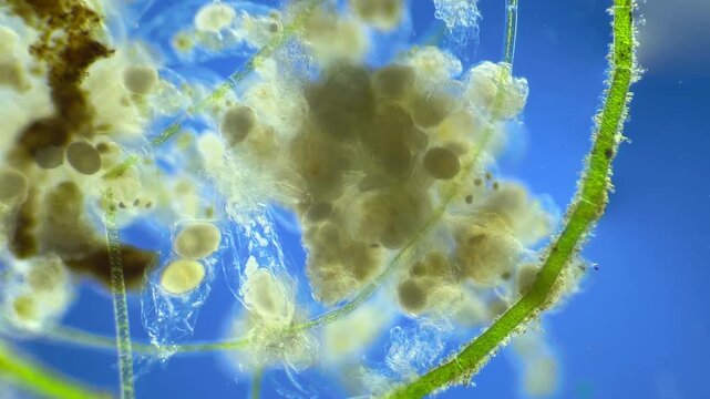Sinantherina （rotifer） under the microscope