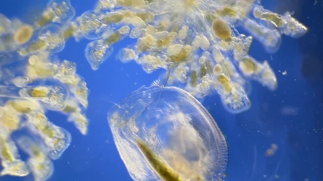 Sinantherina （rotifer） under the microscope