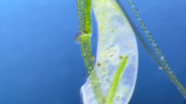 Ciliate Stentor under the microscope at 100x Magnification