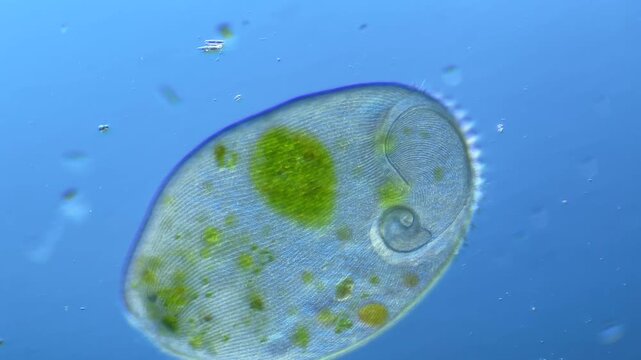Ciliate Stentor under the microscope at 100x Magnification