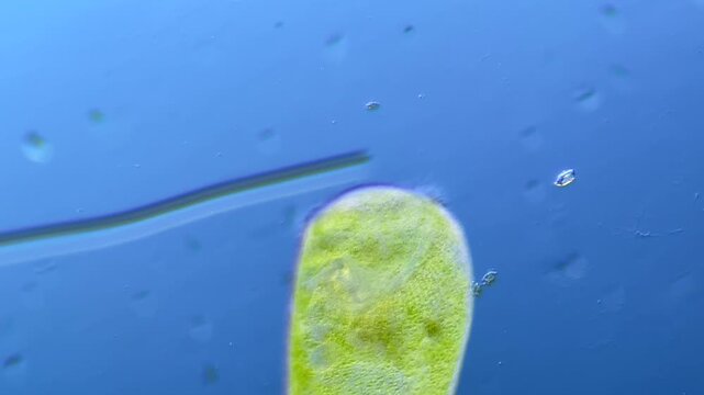 Ciliate Stentor under the microscope at 100x Magnification