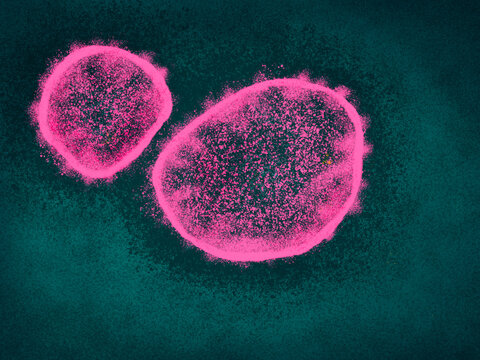 Nipah virus, a deadly zoonotic virus transmitted from bats to humans. Emerging threat, pathogen causing fatal encephalitis and respiratory infection.