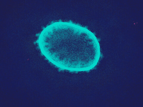 Nipah virus, a deadly zoonotic virus transmitted from bats to humans. Emerging threat, pathogen causing fatal encephalitis and respiratory infection.