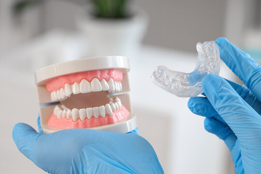 Female dentist's hands with occlusal splint and jaw model in clinic, closeup