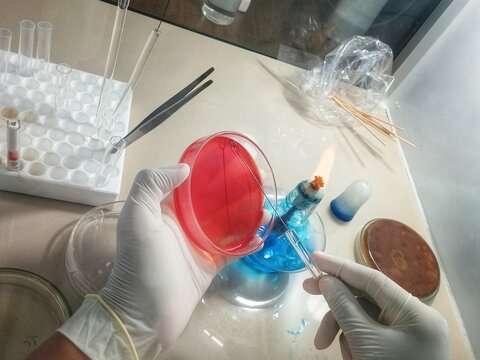 Close-up of a laboratory researcher wearing protective gloves holding a petri dish with red agar culture, representing microbiology, medical research, and biotechnology testing.