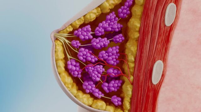 Anatomy of breast hyperplasia, abnormal breast enlargement lead to blood vessel compression, malignant breast tumor, female breast anatomy, women's disease, mastitis, anatomical concept, 3D animation.
