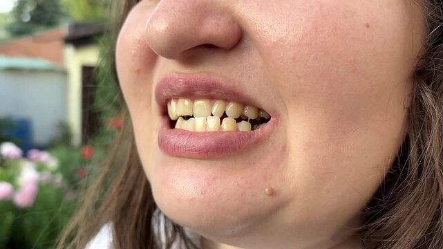 Patient with dislocated jaw and malocclusion, temporomandibular joint dysfunction. She is opening and closing mouth. 