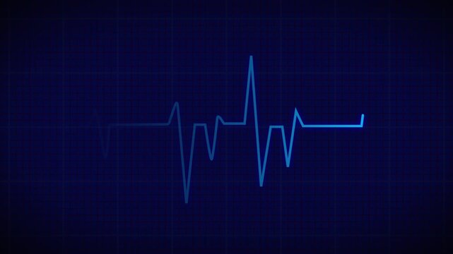 A blue ECG waveform flows across a dark grid, conveying steady heart rhythm, digital diagnostics, and modern medical technology.