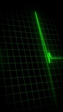 Animation of Endless loop EKG Heart Monitoring display. Full HD. 4K