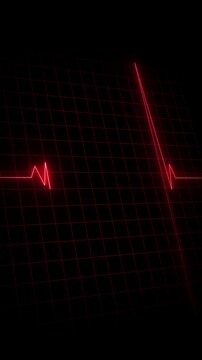 Animation of Endless loop EKG Heart Monitoring display. Full HD. 4K