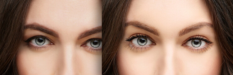 Obraz premium Lower and upper Blepharoplasty.Marking the face.Perforation lines on females face, plastic surgery concept.