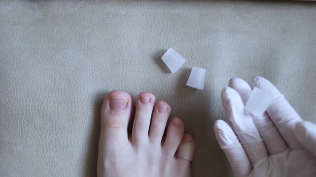 Silicone toe sleeve or cap. Woman puts on protective cover on little toe. Fights corns, prevents blisters and ingrown toenails