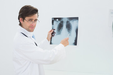 Middle-aged male physician wearing lab coat, stethoscope pointing at chest X-ray with pen in clinic