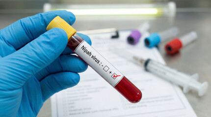 Fototapeta premium Nipah virus blood test sample laboratory research scene with gloved hand
