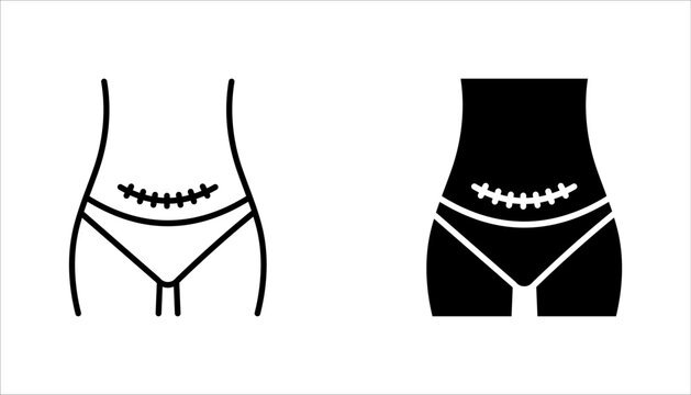 cesarean section icon set with scar, vector illustration on white background